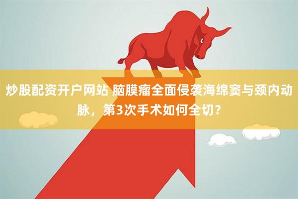 炒股配资开户网站 脑膜瘤全面侵袭海绵窦与颈内动脉，第3次手术如何全切？